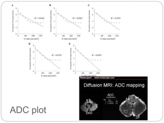 ADC plot
 