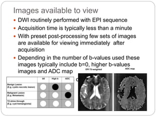 Images available to view
 DWI routinely performed with EPI sequence
 Acquisition time is typically less than a minute
 With preset post-processing few sets of images
are available for viewing immediately after
acquisition
 Depending in the number of b-values used these
images typically include b=0, higher b-values
images and ADC map
 Higher b-value images considered as DWI
 