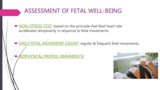 ASSESSMENT OF FETAL WELL-BEING
 NON-STRESS TEST: based on the principle that fetal heart rate
accelerates temporarily in response to fetal movements.
 DAILY FETAL MOVEMENT COUNT: regular & frequent fetal movements.
 BIOPHYSICAL PROFILE (MANNING’S)
 