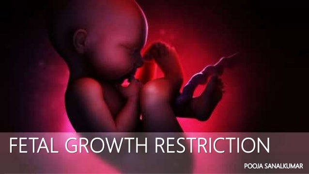 baby small for gestational age