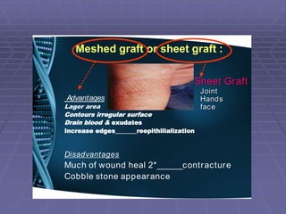 2.plastic surgery | PPT