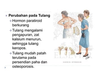  Perubahan pada Tulang
Hormon paratiroid
berkurang
Tulang mengalami
pengapuran, zat
kalsium menurun,
sehingga tulang
keropos.
Tulang mudah patah
terutama pada
persendian paha dan
osteoporosis.
 