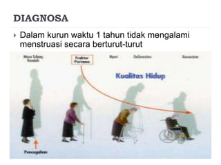 DIAGNOSA
 Dalam kurun waktu 1 tahun tidak mengalami
menstruasi secara berturut-turut
 