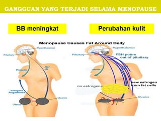 GANGGUAN YANG TERJADI SELAMA MENOPAUSE
BB meningkat Perubahan kulit
 