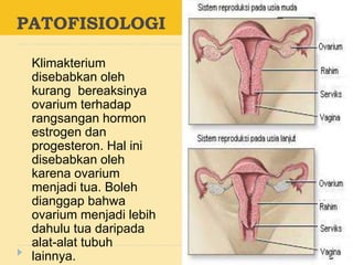 PATOFISIOLOGI
Klimakterium
disebabkan oleh
kurang bereaksinya
ovarium terhadap
rangsangan hormon
estrogen dan
progesteron. Hal ini
disebabkan oleh
karena ovarium
menjadi tua. Boleh
dianggap bahwa
ovarium menjadi lebih
dahulu tua daripada
alat-alat tubuh
lainnya.
 