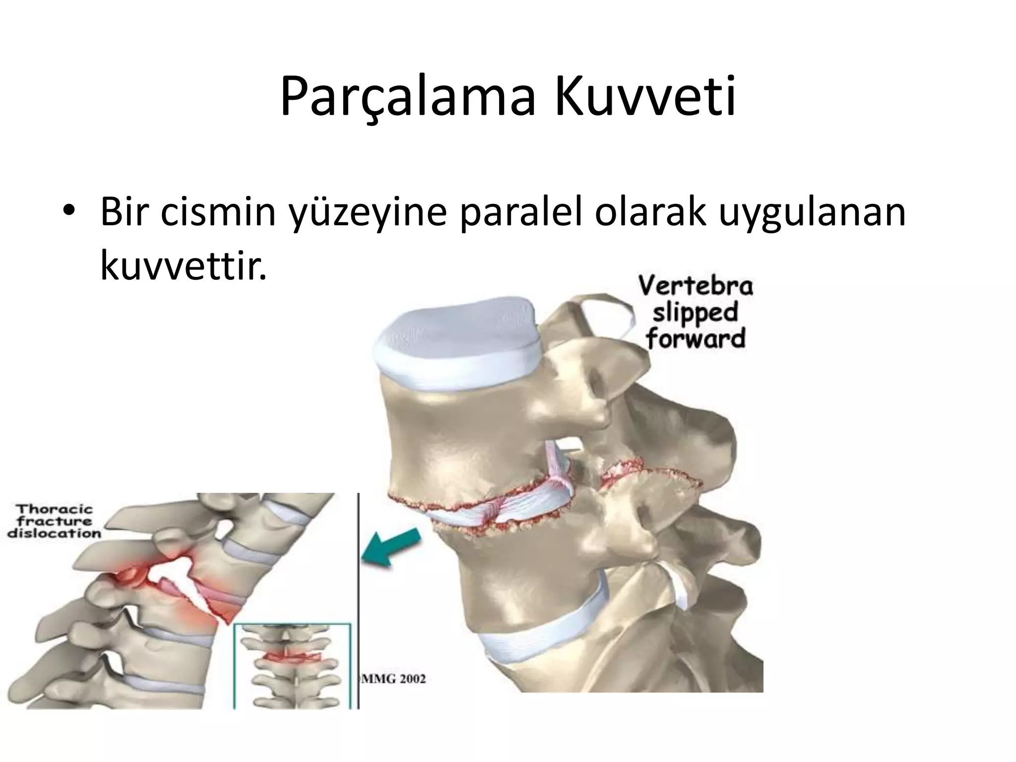 Parçalama Kuvveti
• Bir cismin yüzeyine paralel olarak uygulanan
kuvvettir.
 
