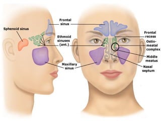Definition Of Paranasal Sinus NCI Dictionary Of Cancer Terms NCI