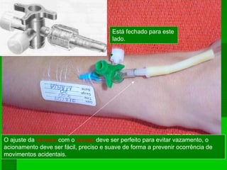 Está fechado para este
lado.
O ajuste da torneira com o equipo deve ser perfeito para evitar vazamento, o
acionamento deve ser fácil, preciso e suave de forma a prevenir ocorrência de
movimentos acidentais.
 