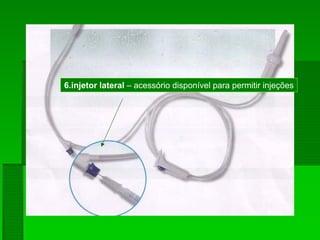6.injetor lateral – acessório disponível para permitir injeções
 