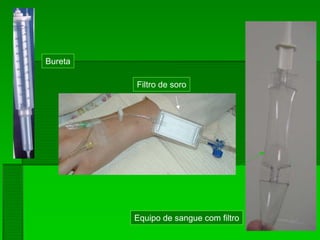 Equipo de sangue com filtro
Bureta
Filtro de soro
 
