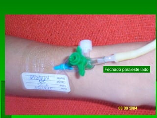 Fechado para este lado
 