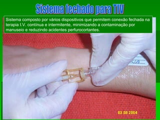 Sistema composto por vários dispositivos que permitem conexão fechada na
terapia I.V. contínua e intermitente, minimizando a contaminação por
manuseio e reduzindo acidentes perfurocortantes.
 