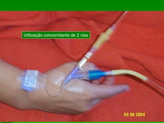 Utilização concomitante de 2 vias
 