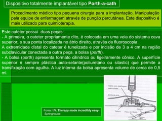 Dispositivo totalmente implantável tipo Porth-a-cath
Este cateter possui duas peças:
- A primeira, o cateter propriamente dito, é colocada em uma veia do sistema cava
superior, e sua ponta localizada no átrio direito, através de fluoroscopia.
A extremidade distal do cateter é tunelizada e por incisão de 3 a 4 cm na região
subclavicular conectada a outra peça, a bolsa (porth).
- A bolsa (porth) apresenta formato cilíndrico ou ligeiramente cônico. A superfície
superior é sempre plástica auto-selante(poliuretano ou silastic) que permite a
transfixação com agulha. A luz interna da bolsa apresenta volume de cerca de 0,5
ml.
Procedimento médico tipo pequena cirurgia para a implantação. Manipulação
pela equipe de enfermagem através de punção percutânea. Este dispositivo é
mais utilizado para quimioterapia.
Fonte: I.V. Therapy made incredibly easy-
Springhouse
 