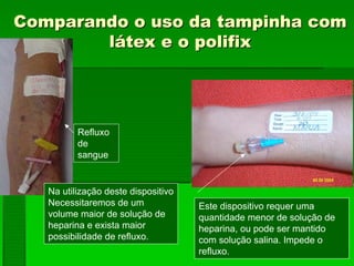 Comparando o uso da tampinha comComparando o uso da tampinha com
látex e o polifixlátex e o polifix
Na utilização deste dispositivo
Necessitaremos de um
volume maior de solução de
heparina e exista maior
possibilidade de refluxo.
Refluxo
de
sangue
Este dispositivo requer uma
quantidade menor de solução de
heparina, ou pode ser mantido
com solução salina. Impede o
refluxo.
 