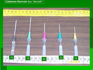 Cateteres flexíveis tipo “abocath”
16 18 20
22 24
 