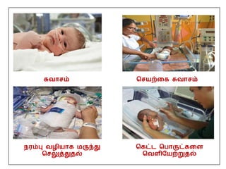 சுவாசம் பசயற்தக சுவாசம்
நரம்பு வழியாக மருந்து
பசலுத்துதல்
பகட்ை பபாருட்கதள
பவளிமயற்றுதல்
 