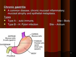Chronic gastritisChronic gastritis
 A common disease, chronic mucosal inflammatory;A common disease, chronic mucosal inflammatory;
mucosal atrophy and epithelial metaplasia.mucosal atrophy and epithelial metaplasia.
TypesTypes
 Type A - auto immune,Type A - auto immune, Site – BodySite – Body
 Type B – H. Pylori infectionType B – H. Pylori infection Site – AntrumSite – Antrum
  
1010
 