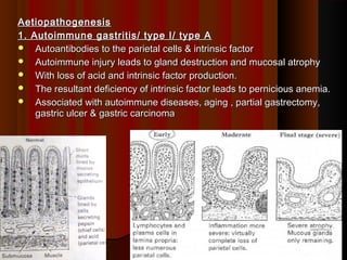 AetiopathogenesisAetiopathogenesis
1. Autoimmune gastritis/ type I/ type A1. Autoimmune gastritis/ type I/ type A
 Autoantibodies to the parietal cells & intrinsic factorAutoantibodies to the parietal cells & intrinsic factor
 Autoimmune injury leads to gland destruction and mucosal atrophyAutoimmune injury leads to gland destruction and mucosal atrophy
 With loss of acid and intrinsic factor production.With loss of acid and intrinsic factor production.
 The resultant deficiency of intrinsic factor leads to pernicious anemia.The resultant deficiency of intrinsic factor leads to pernicious anemia.
 Associated with autoimmune diseases, aging , partial gastrectomy,Associated with autoimmune diseases, aging , partial gastrectomy,
gastric ulcer & gastric carcinomagastric ulcer & gastric carcinoma
1111
 