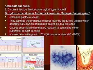 AetiopathogenesisAetiopathogenesis
2. Chronic infection /Helicobacter pylori/ type II/type B2. Chronic infection /Helicobacter pylori/ type II/type B
H. pylori:H. pylori: crucial role/ formerly known ascrucial role/ formerly known as Campylobacter pyloriCampylobacter pylori
 colonizes gastric mucosa:colonizes gastric mucosa:
 They damage the protective mucous layer by producing urease whichThey damage the protective mucous layer by producing urease which
generate NH3 (which neutralizes gastric acid) & proteasegenerate NH3 (which neutralizes gastric acid) & protease
 Causes superficial inflammatory reaction to continuing minorCauses superficial inflammatory reaction to continuing minor
superficial cellular damagesuperficial cellular damage
 Is associated with gastric (70% )& duodenal ulcer (90 -100%)Is associated with gastric (70% )& duodenal ulcer (90 -100%)
1313
 