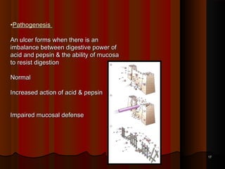 •PathogenesisPathogenesis
An ulcer forms when there is anAn ulcer forms when there is an
imbalance between digestive power ofimbalance between digestive power of
acid and pepsin & the ability of mucosaacid and pepsin & the ability of mucosa
to resist digestionto resist digestion
  
NormalNormal
Increased action of acid & pepsinIncreased action of acid & pepsin
Impaired mucosal defenseImpaired mucosal defense
1717
 