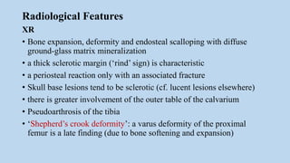 Radiological Features
XR
• Bone expansion, deformity and endosteal scalloping with diffuse
ground-glass matrix mineralization
• a thick sclerotic margin (‘rind’ sign) is characteristic
• a periosteal reaction only with an associated fracture
• Skull base lesions tend to be sclerotic (cf. lucent lesions elsewhere)
• there is greater involvement of the outer table of the calvarium
• Pseudoarthrosis of the tibia
• ‘Shepherd’s crook deformity’: a varus deformity of the proximal
femur is a late finding (due to bone softening and expansion)
 