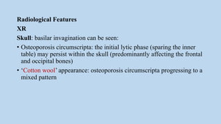 Radiological Features
XR
Skull: basilar invagination can be seen:
• Osteoporosis circumscripta: the initial lytic phase (sparing the inner
table) may persist within the skull (predominantly affecting the frontal
and occipital bones)
• ‘Cotton wool’ appearance: osteoporosis circumscripta progressing to a
mixed pattern
 
