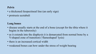Pelvis
• a thickened ileopectineal line (an early sign)
• protrusio acetabuli
Long bones
• disease usually starts at the end of a bone (except for the tibia where it
begins in the tuberosity)
• as it extends into the diaphysis it is demarcated from normal bone by a
V-shaped zone of transition (‘flameshaped’ lysis)
• there is an increased cortical width
• weakened bones can bow under the stress of weight bearing
 