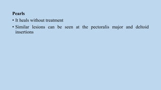 Pearls
• It heals without treatment
• Similar lesions can be seen at the pectoralis major and deltoid
insertions
 