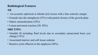 Radiological Features
XR
• An eccentric spherical or lobular lytic lesion with a fine sclerotic margin
• Extends into the metaphysis (55%) with partial closure of the growth plate
• Matrix mineralization (10%)
• Linear periosteal reaction (30–50%)
MRI T2WI:
• Variable SI including fluid levels due to secondary aneurysmal bone cyst
change (15%)
• Associated marrow and soft tissue oedema
• Reactive joint effusion in the epiphysis (40%)
 
