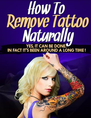 The Laserless Tattoo Removal Guide™ by Dorian Davis
 