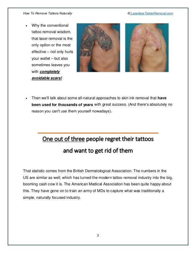 How Can I Remove My Tattoo Without Laser Tattoo Vanish Cost