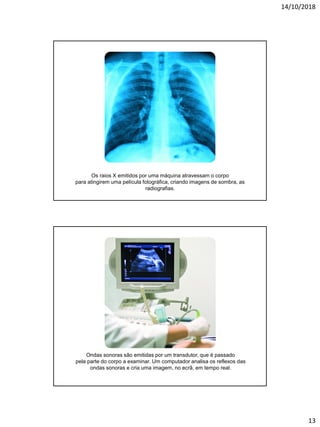 14/10/2018
13
Os raios X emitidos por uma máquina atravessam o corpo
para atingirem uma película fotográfica, criando imagens de sombra, as
radiografias.
Ondas sonoras são emitidas por um transdutor, que é passado
pela parte do corpo a examinar. Um computador analisa os reflexos das
ondas sonoras e cria uma imagem, no ecrã, em tempo real.
 