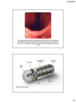 14/10/2018
14
Os endoscópios, aparelhos dotados de uma fonte de luz e de tecnologia
de imagem, podem ser inseridos em orifícios naturais, como a boca ou o
ânus, ou em incisões cirúrgicas, para produzirem imagens do interior do
corpo.
Cápsula
ótica
Focos de luz
Transmissor
e antena
Baterias
Lente
Reconhecimento
de imagens
Cápsula endoscópica
 