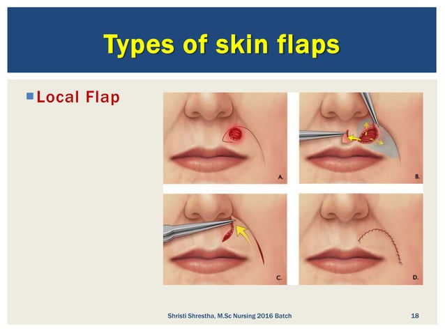 2.1. plastic surgery