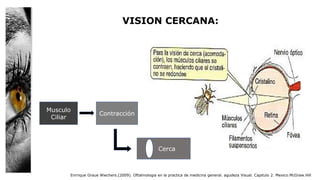 VISION CERCANA:
Enrrique Graue Wiechers.(2009). Oftalmologia en la practica de medicina general. agudeza Visual. Capitulo 2. Mexico.McGraw.Hill
Musculo
Ciliar
Contracción
Cerca
 