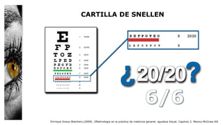 CARTILLA DE SNELLEN
Enrrique Graue Wiechers.(2009). Oftalmologia en la practica de medicina general. agudeza Visual. Capitulo 2. Mexico.McGraw.Hill
 