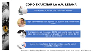 COMO EXAMINAR LA A.V. LEJANA
Enrrique Graue Wiechers.(2009). Oftalmologia en la practica de medicina general. agudeza Visual. Capitulo 2. Mexico.McGraw.Hill
Situar al Px a 6m de una cartilla de Snellen
Tape perfectamente un ojo con un oclusor o la palma de la
mano
Si el paciente ve menos de 20/40 con un ojo o con los dos
ojos, es necesario repetir la prueba viendo a través de un
agujero estenopeico
Anote los resultados de la letra más pequeña que el
paciente puede ver.
 