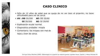 CASO CLINICO
 Niño de 12 años de edad que se queja de no ver bien el pizarrón; no tiene
dificultades para ver de cerca.
 AV : OD 20/200 AE: OD 20/60
OI 20/200 AE: OI 20/60
 Exploración ocular normal.
 Diagnostico probable: miopía
 Comentario: los miopes ven mal de
lejos y bien de cerca.
Enrrique Graue Wiechers.(2009). Oftalmologia en la practica de medicina general. agudeza Visual. Capitulo 2. Mexico.McGraw.Hill
 