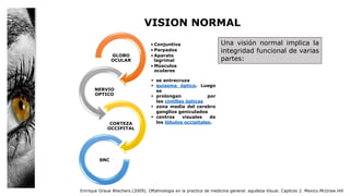 VISION NORMAL
• Conjuntiva
• Parpados
• Aparato
lagrimal
• Músculos
oculares
GLOBO
OCULAR
NERVIO
OPTICO
CORTEZA
OCCIPITAL
SNC
Una visión normal implica la
integridad funcional de varias
partes:
Enrrique Graue Wiechers.(2009). Oftalmologia en la practica de medicina general. agudeza Visual. Capitulo 2. Mexico.McGraw.Hill
 se entrecruza
 quiasma óptico. Luego
se
 prolongan por
las cintillas ópticas
 zona media del cerebro
ganglios geniculados
 centros visuales de
los lóbulos occipitales.
 