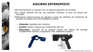 AGUJERO ESTENOPEICO
Es técnicamente un oclusor con un agujero pequeño en el centro
Se coloca delante del ojo del paciente mientras el otro se ocluye por
completo
Diferenciar disminuciones de agudeza visual por defectos de refracción de
aquellas causadas por enfermedades oculares
o Catarata: opacidad del cristalino
o Uveítis: pupila irregular por inflamación del iris
o Glaucoma: aumento de la presión ocular por déficit de drenaje
(nublamiento corneal, congestión ciliar, dilatación pupilar)
https://es.wikipedia.org/wiki/Agujero_estenopeico
 