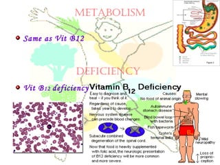 METABOLISM
Same as Vit B12
Vit B12 deficiency
DEfICIENCy
 