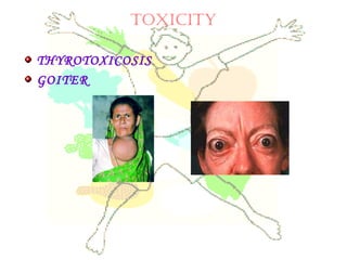toxicity
THYROTOXICOSIS
GOITER
 