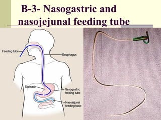 B-3- Nasogastric and
nasojejunal feeding tube
 