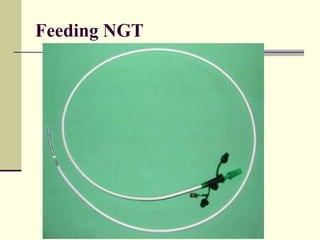 Feeding NGT
 