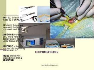 ELECTROSURGERY
•INITIAL Incision is
made by a SCALPEL
•Doubling the current
increases the heat
produced fourfold
•ARGON Enhanced
ESU Tip is held at 60
degree angle, causing
LESS Tissue Damage
•BUZZING – the
process of coagulating
the VESSELS
•BUZZ should not
exceed more than 3
SECONDS
nursinglectures.blogspot.com
 