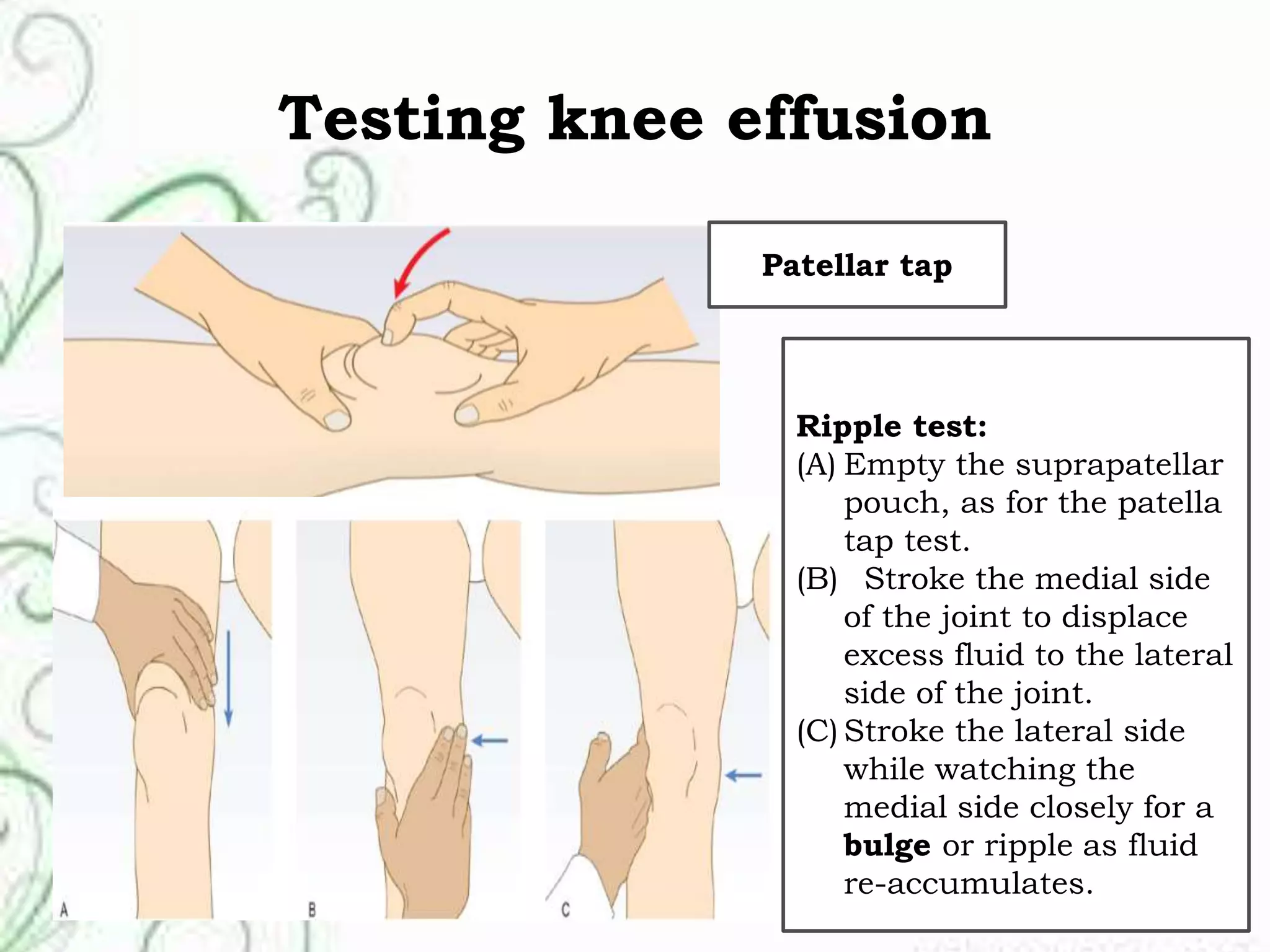 Tap Teste musculoskeletal Disorders | PPTX