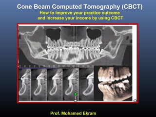 Prof. Mohamed Ekram
Cone Beam Computed Tomography (CBCT)
How to improve your practice outcome
and increase your income by using CBCT
 
