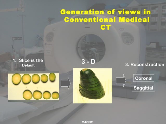 Basic applications of CBCT | PPT | 3-D Graphics | Computer Software and ...