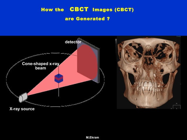 Basic applications of CBCT | PPT | 3-D Graphics | Computer Software and ...